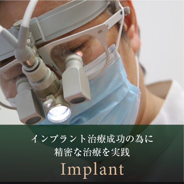 インプラント